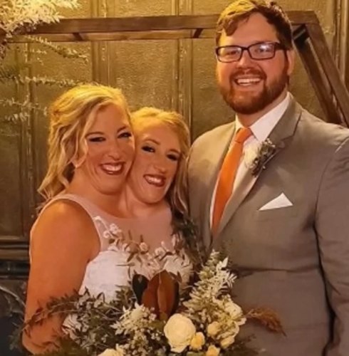 "Conjoined Twin's Marriage Shocks the World: Husband's Role Sparks Mystery."