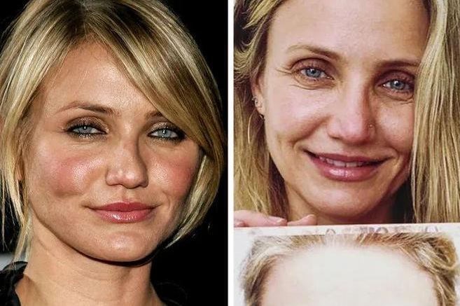OMG! 10 Hollywood Stars Who Openly Admitted: "I Regret My Cosmetic Surgery!"